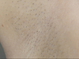 300人の腋 2 サンプル動画サムネイル